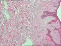 右侧乳腺图15
