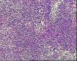 颈部淋巴结图19