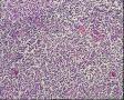颈部淋巴结图17