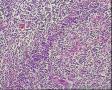颈部淋巴结图18