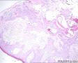 女，腭部肿块，临床考虑腭癌，海量图片，请指导图7