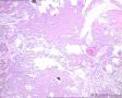 女，腭部肿块，临床考虑腭癌，海量图片，请指导图8