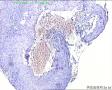 请教能诊断局灶癌变吗？图18