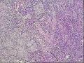 颈部淋巴结图2