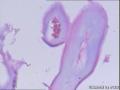 乳腺寄生虫病？图9