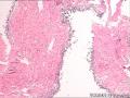 膀胱粘膜待诊图4