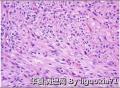 学习 Parathyroid adenoma图2