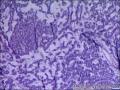甲状腺，请教老师。图10