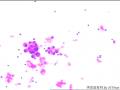 胸水，请会诊！图26