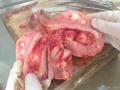 是息肉还是腺肉瘤？？？？？图1