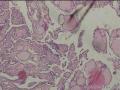 甲状腺图3