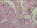 甲状腺图2