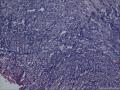 请各位老师帮看这个胆囊图17