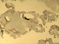 鼻咽部质地脆组织图8