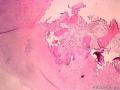 请老师们看看这个骶髂关节组织图2