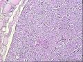 求助，甲状腺左叶怎么报啊？图2