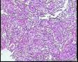 请教！膀胱新生物。图9