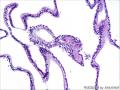 老师帮我看看是分泌期子宫内膜吗？图23