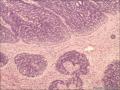 鼻背新生物图4