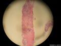 乳腺穿刺标本  腺样囊性癌or浸润性导管癌？图2