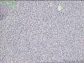 上肢肿物，请教？图3