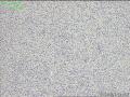 上肢肿物，请教？图1