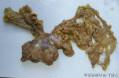 肠系膜囊肿，囊状淋巴管瘤？图2