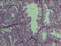 子宫内膜图11