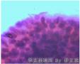 宫颈刮片图7
