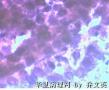 宫颈刮片、绝经图8
