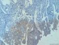求助。第一次做免疫组化，不知问题出在哪里T T图1