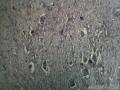 腿部肿物，不会是肉瘤吧？？？？图4