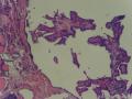 右侧甲状腺肿物，请教图7