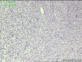 颈部肿物，请教请教？图1