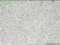 颈部肿物，请教请教？图2