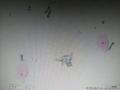 37岁，宫颈液基图1