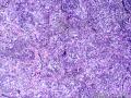 颈部淋巴结图19