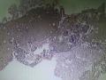 次全切子宫图17