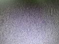 次全切子宫图21