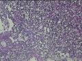 距肛门8cm处粘膜图36