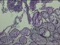 距肛门8cm处粘膜图10