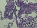 距肛门8cm处粘膜图19