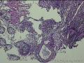 距肛门8cm处粘膜图13
