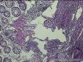 距肛门8cm处粘膜图6