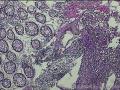 距肛门8cm处粘膜图5