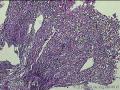 距肛门8cm处粘膜图4