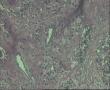 急！请老师看看82岁前列腺增生图10