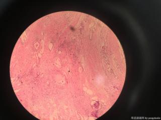请教各位老师，这个前列腺有问题吗？图3