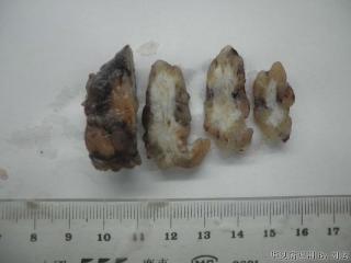 请老师们看看这个卵巢肿块图1