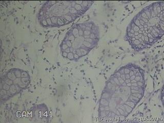 降结肠粘膜图14